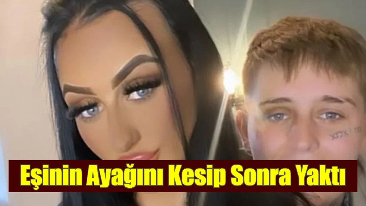 Eşinin Ayağını Kesip Sonra Yaktı